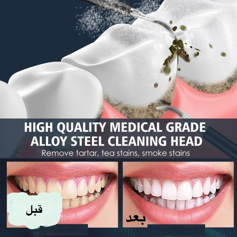 مسواک برقی مدل DentalPro-X1 به همراه 6 سری مسواک و جرمگیر