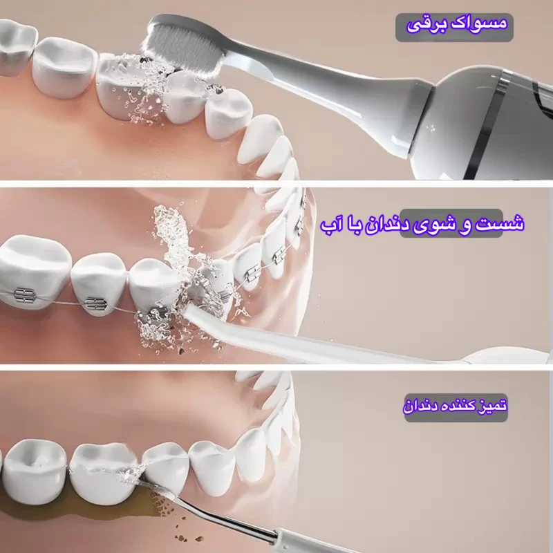 دستگاه شست‌وشوی دهان و دندان شارژی مدل HF-998  به همراه 6 سری